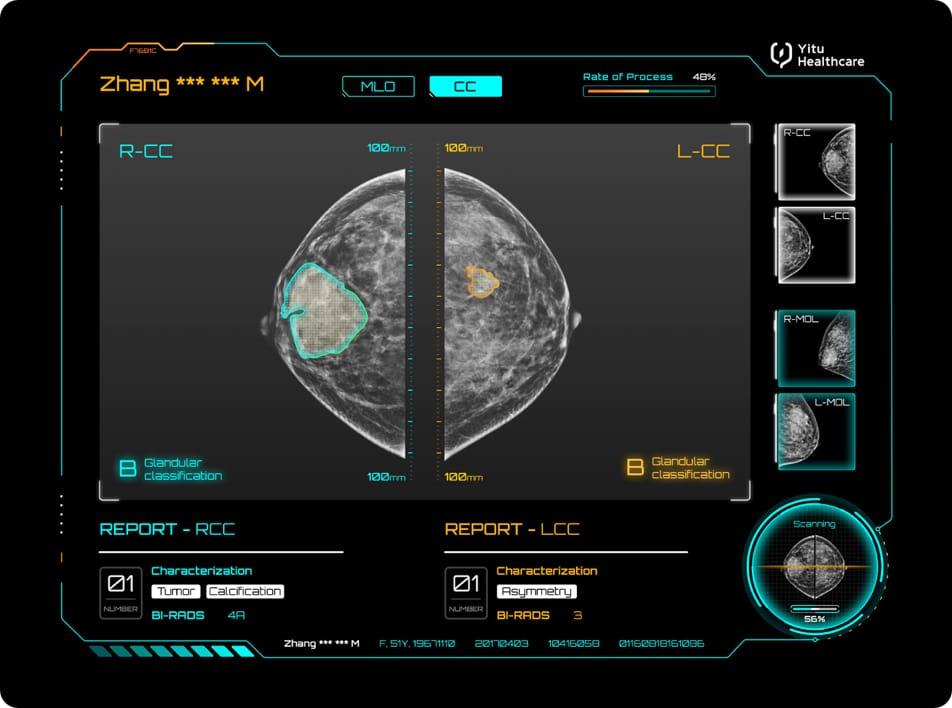care.aiTM 乳腺X線智能診斷系統(tǒng)