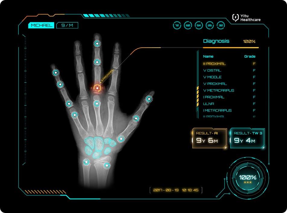 care.aiTM 兒童生長發(fā)育智能診斷系統(tǒng)